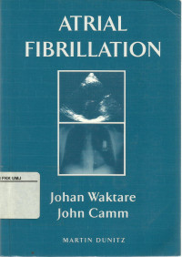 Antrial Fibrillation