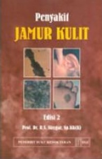 Penyakit Jamur Kulit