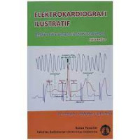 Elektrokardiografi Ilustratif: Belajar EKG dengan Illustrasi sederhana