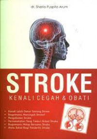 Stroke: Kenali cegah dan obati