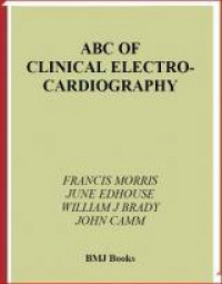 ABC of Clinical Elektro-Cardiography