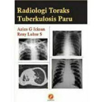 Radiologi Toraks Tuberkulosis Paru