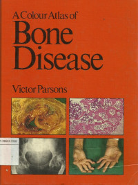 Image of A Colour atlas of Bone Disease