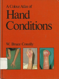 A Colour atlas of Hand Conditions
