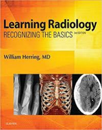 Learning Radiology: Recognizing The Basic